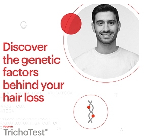 Fagron Trichotest DNA test for hair loss Southampton