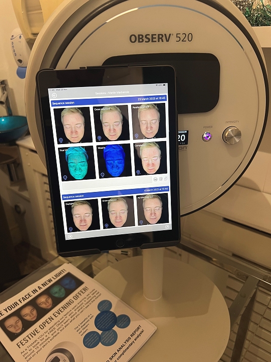 visia complexion analysis southampton