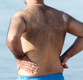 Laser Hair Removal for men southampton