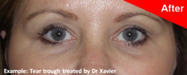 under eye treatments southampton