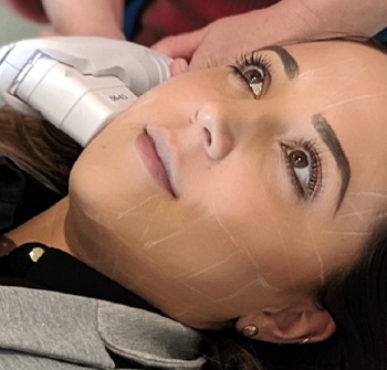 hifu Non-surgical Face and Neck Lifting southampton