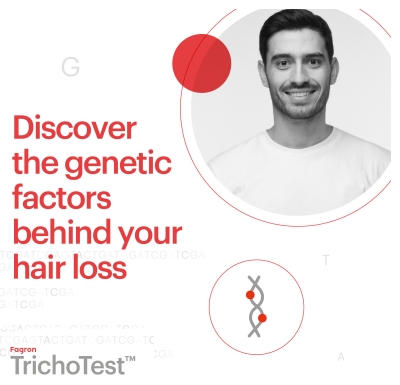 Fagron Trichotest DNA test for hair loss Southampton